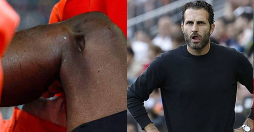 Valence : Ruben Baraja a réagi à la blessure de Diakhaby