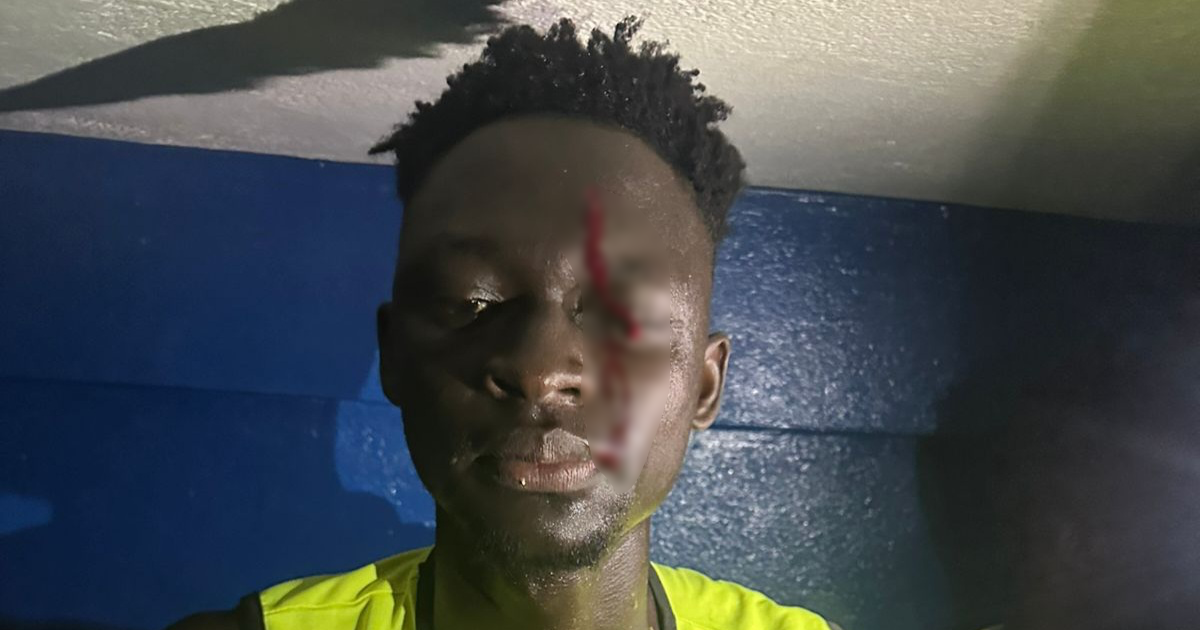 Ligue 1 Guicopres : des sanctions lourdes face à une vi0lence persistante, l’arbitrage toujours au centre